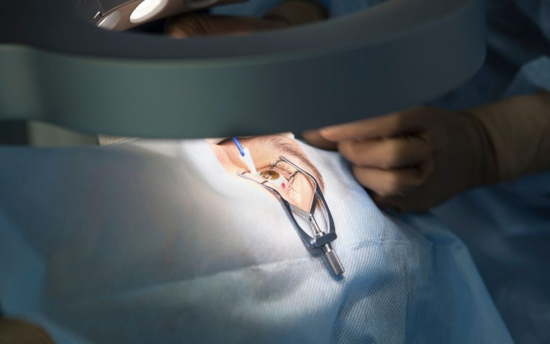 Prix de la chirurgie réfractive au laser à La Rochelle : coûts et remboursement