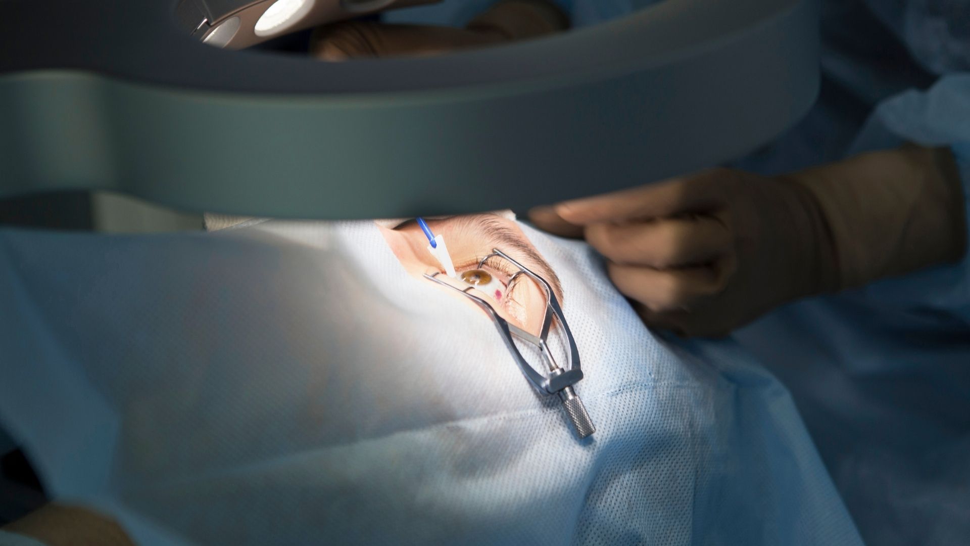 chirurgie réfractive laser La Rochelle